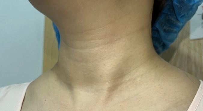 體態矯正 體態矯正