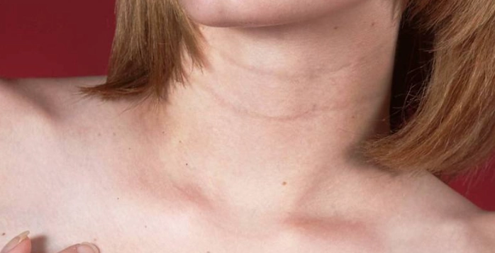 頸粗運勢 頸粗運勢