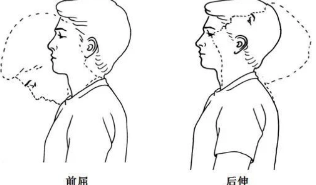 居家頸紋消除 居家頸紋消除