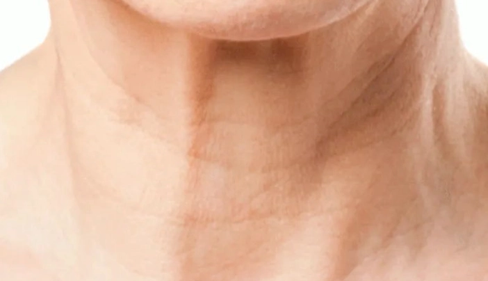 脖子粗穿搭 脖子粗穿搭