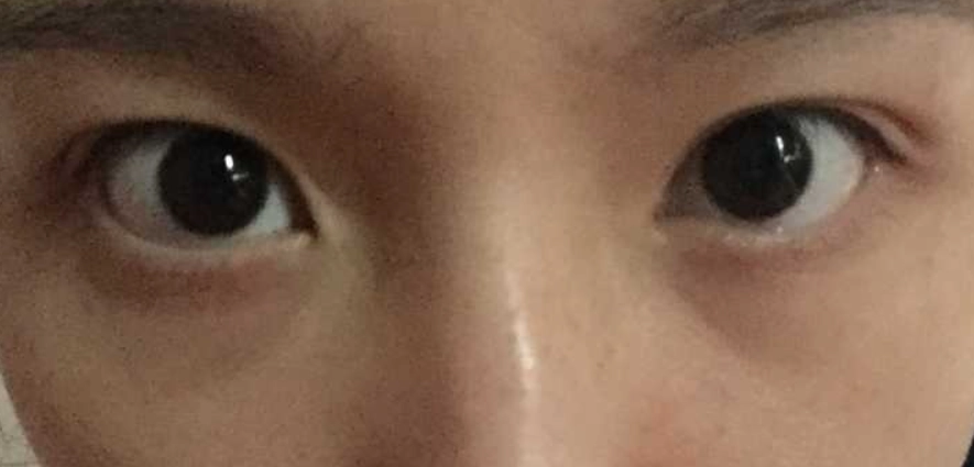 鏡頭不對稱 拍照 鏡頭不對稱 拍照