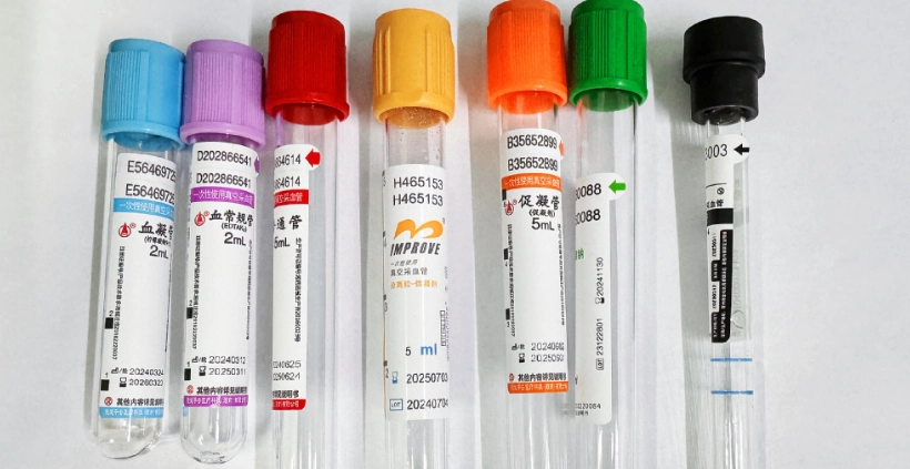 抽血檢查過敏原 抽血檢查過敏原