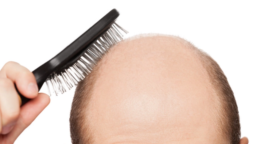 頭髮稀疏洗頭水怎麼選？專家教你避開地雷，找回濃密秀髮