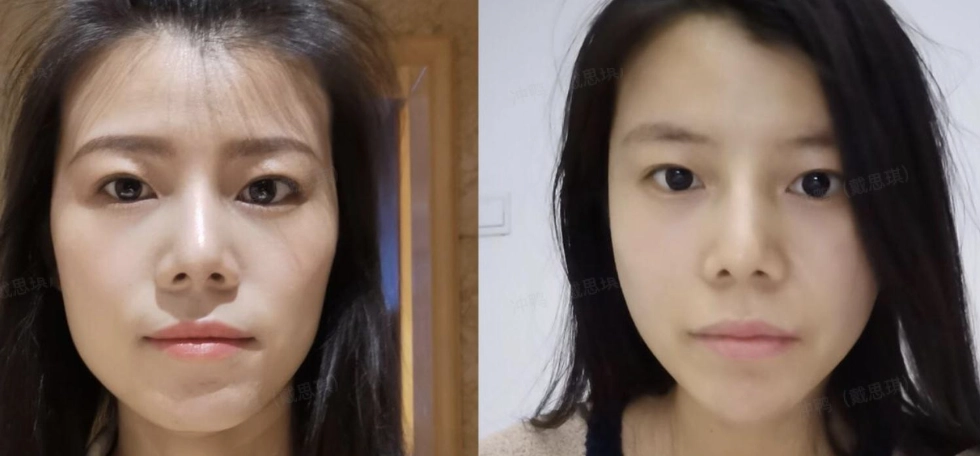 脸部运动 脸部运动