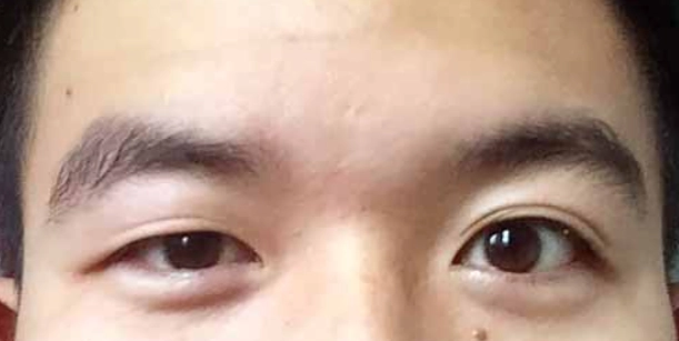 面相健康 面相健康