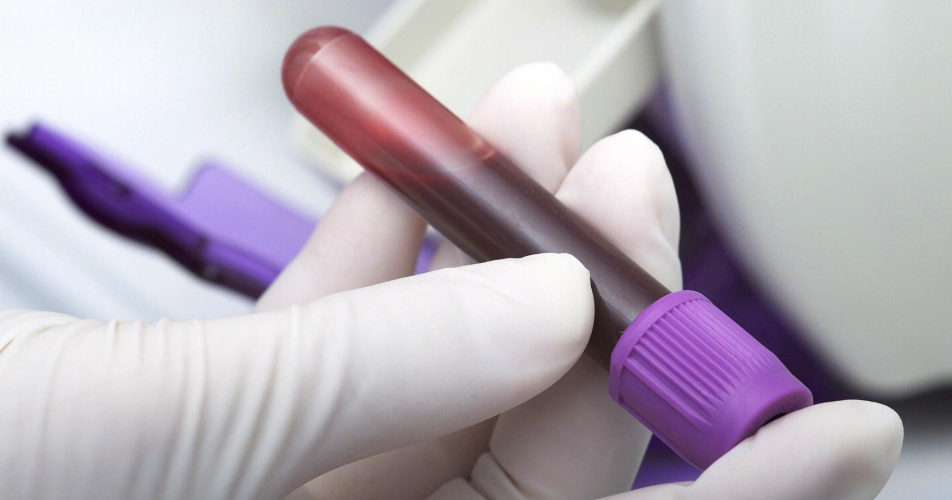 抽血檢查過敏原 抽血檢查過敏原