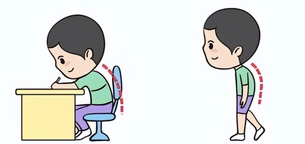 兒童駝背矯正運動指南：居家練習與專業方法