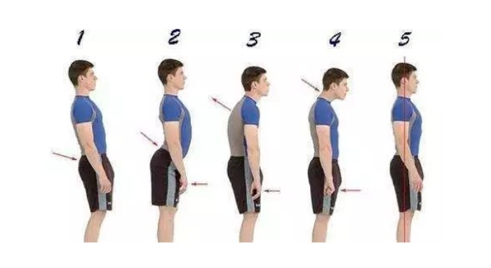 駝背運動 駝背運動