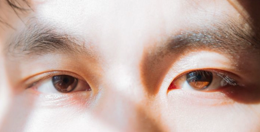 眼睛平均大小全解析：標準測量、健康影響與常見迷思