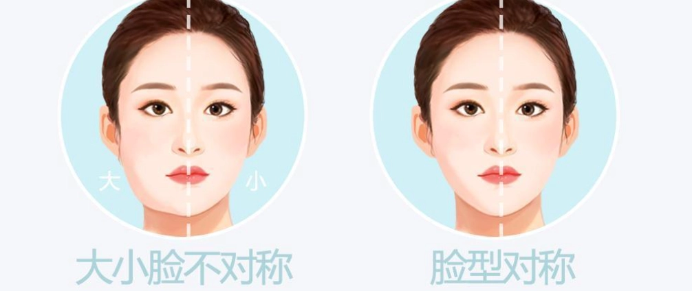 臉部不對稱矯正 臉部不對稱矯正