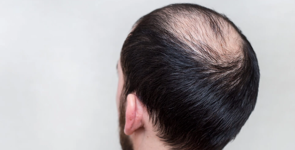 髮量少髮型推薦 髮量少髮型推薦