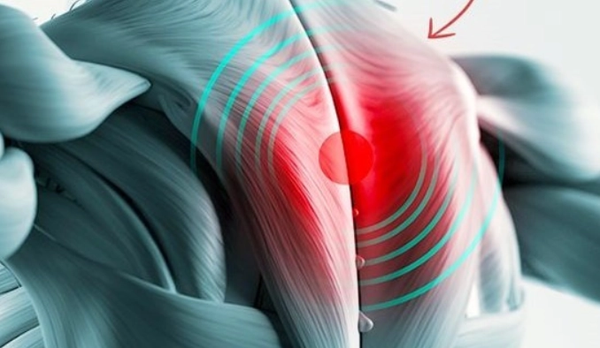 上背部疼痛原因 上背部疼痛原因