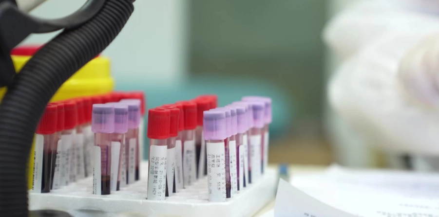 抽血檢查過敏原 抽血檢查過敏原