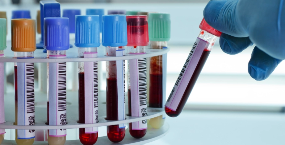 皮膚病抽血項目 皮膚病抽血項目