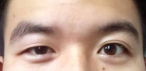 大小眼化妝技巧 大小眼化妝技巧