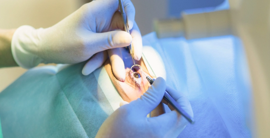 雷射近視恢復期症狀 雷射近視恢復期症狀