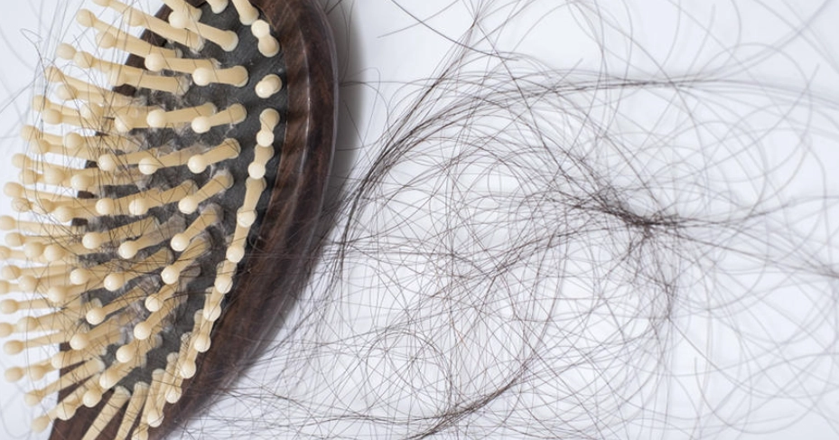 乳清蛋白掉髮 乳清蛋白掉髮