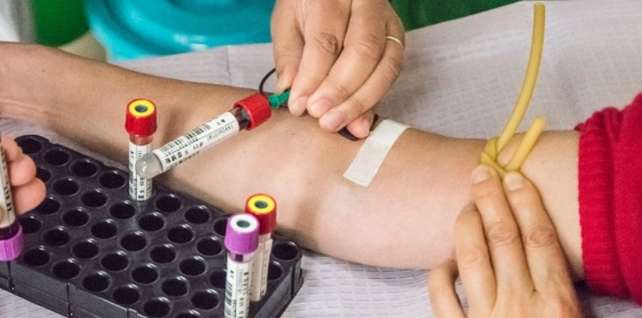 皮膚病抽血項目 皮膚病抽血項目