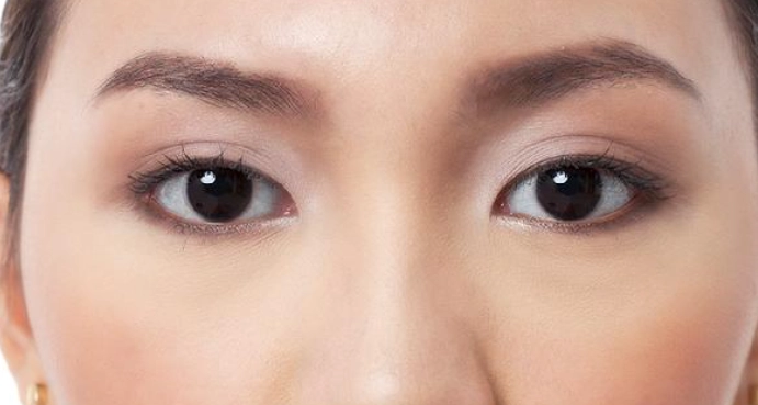 眼睛一高一低怎麼辦？專家解析原因、檢測與改善方法
