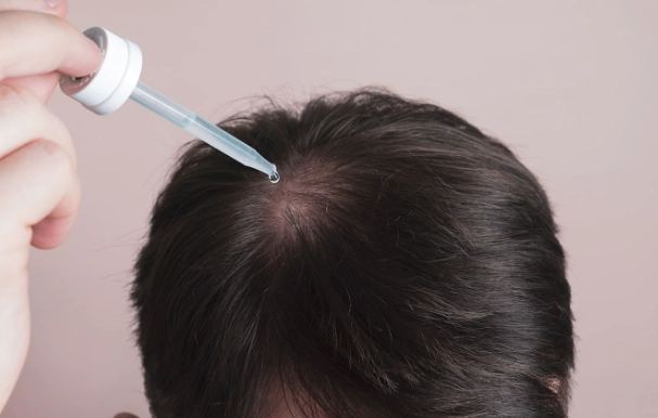 生髮水推薦 生髮水推薦