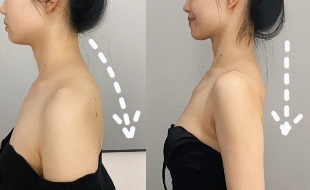 厚背減肥15天見效：告別虎背熊腰的實用指南