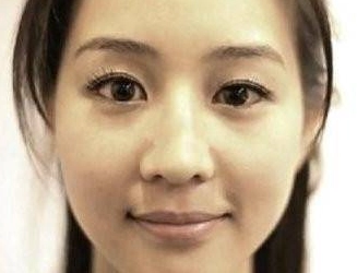 右眼大左眼小原因 右眼大左眼小原因