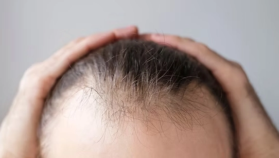 落髮醫生推薦：台灣專業脫髮治療醫師與診所完整指南