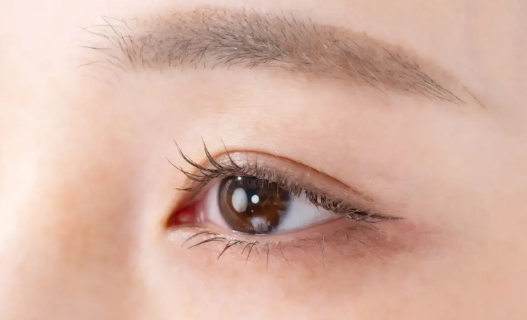 眼睛不對稱改善 眼睛不對稱改善