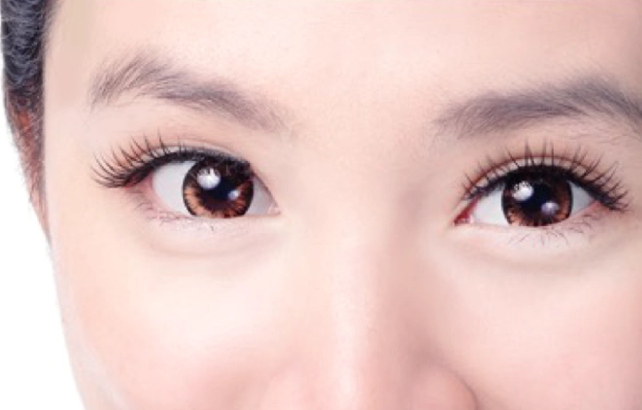 台灣提眼瞼肌手術價錢