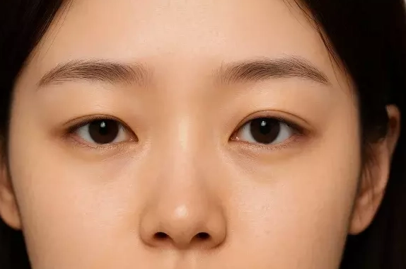 眼睛大小不一 眼睛大小不一