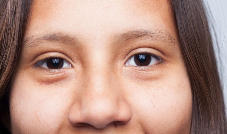 左眼大右眼小面相