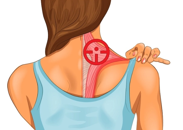 上斜方肌硬塊自救指南：告別烏龜頸與頑固痠痛