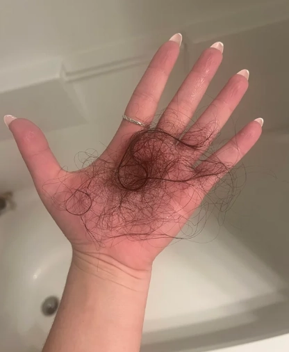 掉髮量正常範圍