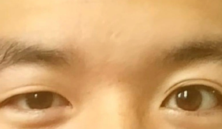 高低眉大小眼面相全解析：性格、命運與實用改善指南