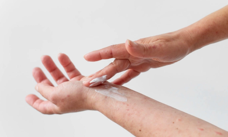 過敏性鼻炎 過敏性鼻炎