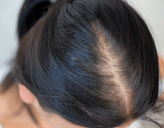 頭皮檢測診所 頭皮檢測診所