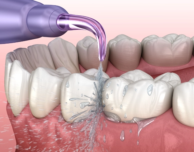 沖牙機使用心得全攻略：從選購技巧到日常清潔一次掌握