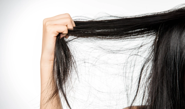 頭皮護理技巧 頭皮護理技巧