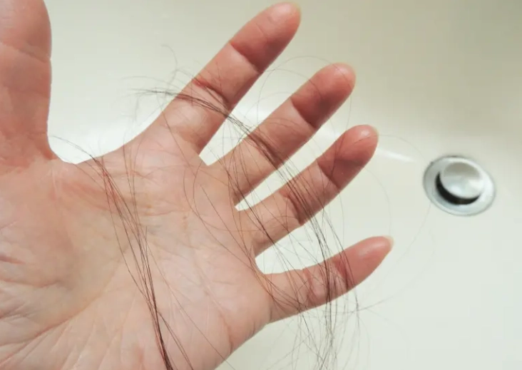 掉髮量正常範圍