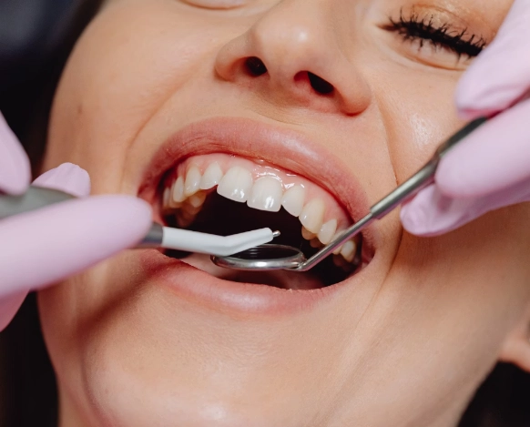 牙周翻瓣手術後牙齦萎縮怎麼辦？醫師詳解原因與補救方法