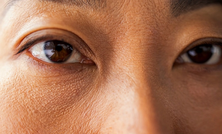 右眼大左眼小原因 右眼大左眼小原因