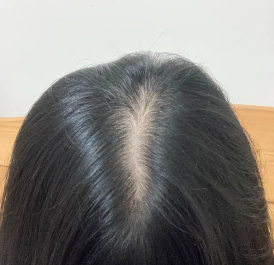 頭皮檢測診所 頭皮檢測診所