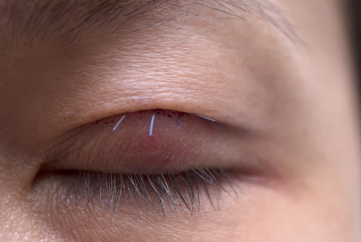 左眼大右眼小面相