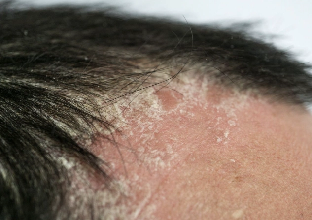 頭皮皮膚科推薦：台北專業診所選擇指南與常見問題解答