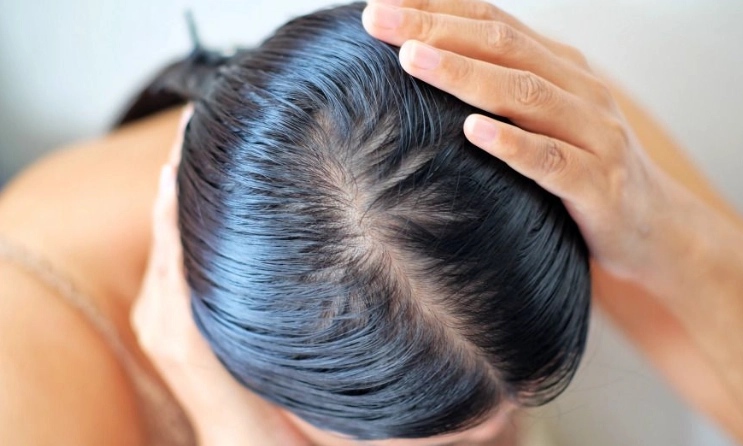 生髮保健食品 生髮保健食品