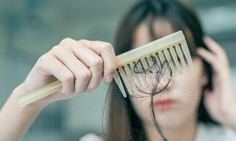 女性禿頭前兆 女性禿頭前兆