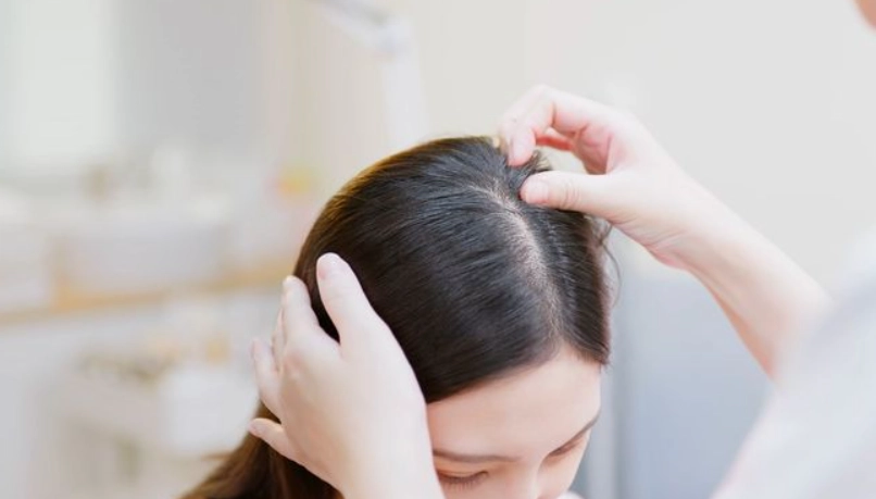 髮量稀疏怎麼辦 髮量稀疏怎麼辦