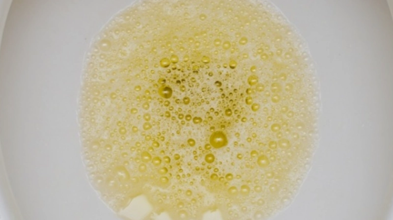 蛋白尿飲食禁忌指南：這6類食物要小心，保護腎臟從口開始