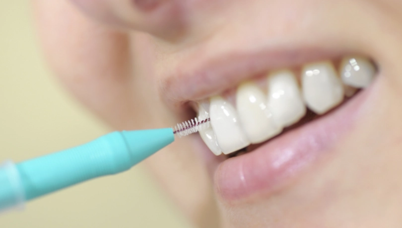 牙間刷更換頻率 牙間刷更換頻率