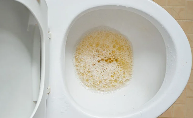 腎臟病飲食 腎臟病飲食